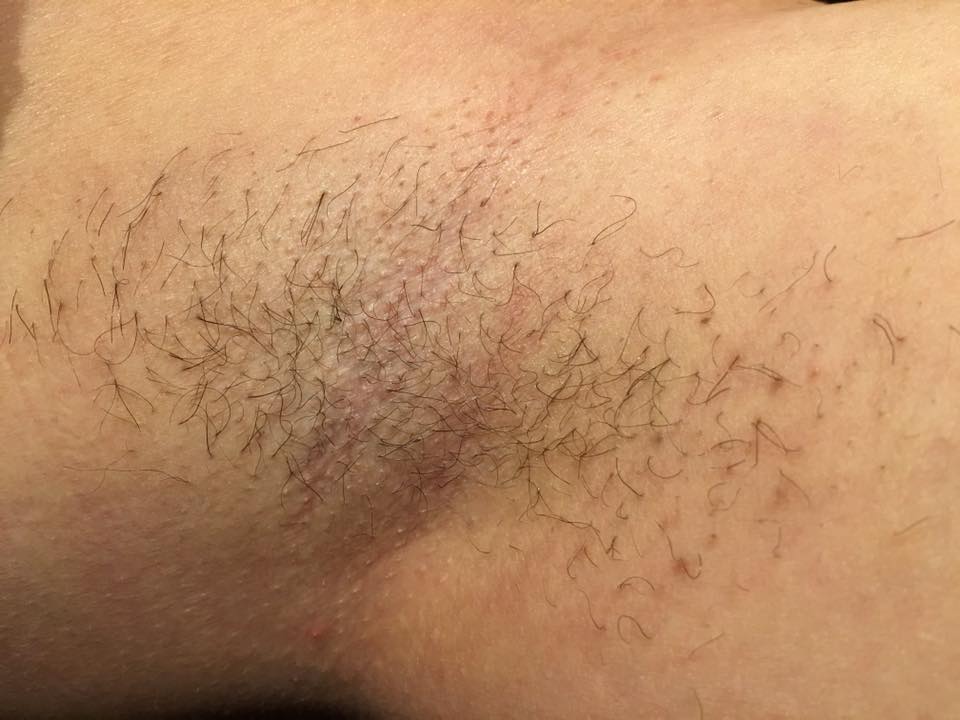 Voks axil (under armene)