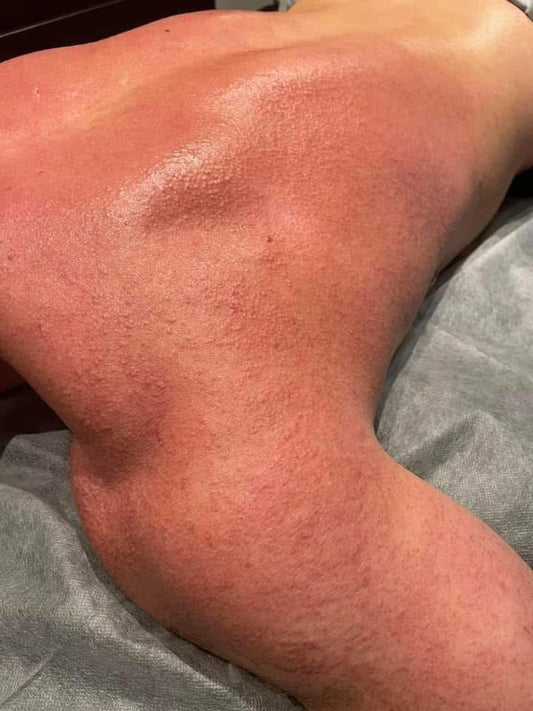Rygmassage